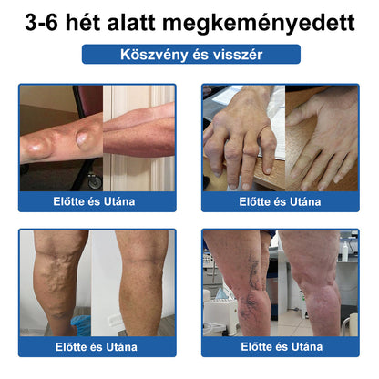 🏃 Medistart® 3 az 1-ben regeneráló krém ✨Ízületek és csontok számára, 5 perces fájdalomcsillapítás - 50 ml