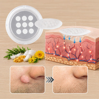 🧑‍⚕️ PuraCure® 2 az 1-ben mikrotűs és hidrokolloid tapasz🍀 | Kiálló anyajegyek, aknék, lapos szemölcsök és bőrnövedékek eltávolítására | Segít csökkenteni a ráncokat, hegeket és bőrhibákat | Láthatatlan tapasz az arcra és testre