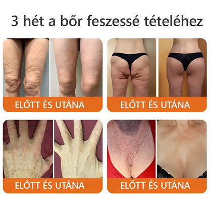 🧑‍⚕️ ZödVita® Méhméreg Bőr Helyreállító Krém 🐝🔥Magyar fejlesztés, magyarországi gyártás és szállítás