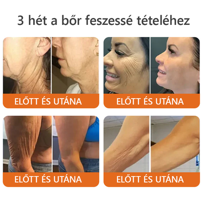 🧑‍⚕️ ZödVita® Méhméreg Bőr Helyreállító Krém 🐝🔥Magyar fejlesztés, magyarországi gyártás és szállítás