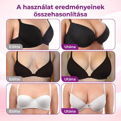 🔥Medistart® Célzott Mellnagyobbító Fejlett Nano Mikrotűs Tapasz