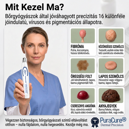 🔥PuraCure® 𝟕 𝐍𝐚𝐩𝐨𝐬 Bőrkinövés- és Folteltávolító Toll Fájdalommentes és Hegmentes Professzionális Rollerball