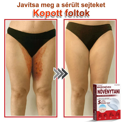 ✨PuraCure® Mikro-tűs botanikai bőrnövedék-eltávolító ✅✅Készült Magyarországon