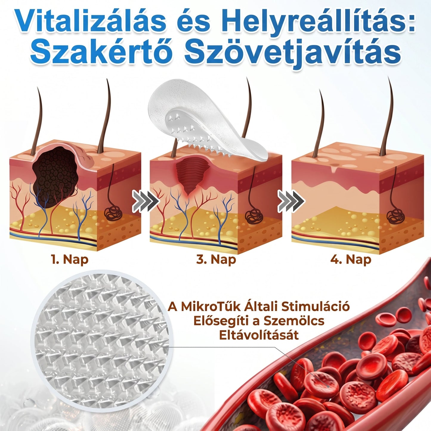 🧑‍⚕️ PuraCure® 2 az 1-ben mikrotűs és hidrokolloid tapasz🍀 | Kiálló anyajegyek, aknék, lapos szemölcsök és bőrnövedékek eltávolítására | Segít csökkenteni a ráncokat, hegeket és bőrhibákat | Láthatatlan tapasz az arcra és testre