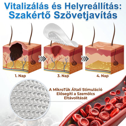 🧑‍⚕️ PuraCure® 2 az 1-ben mikrotűs és hidrokolloid tapasz🍀 | Kiálló anyajegyek, aknék, lapos szemölcsök és bőrnövedékek eltávolítására | Segít csökkenteni a ráncokat, hegeket és bőrhibákat | Láthatatlan tapasz az arcra és testre