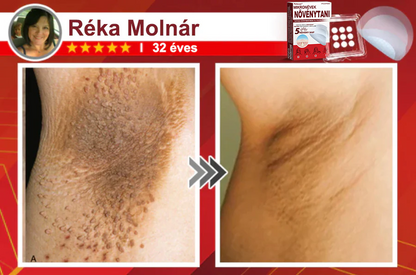 ✨PuraCure® Mikro-tűs botanikai bőrnövedék-eltávolító ✅✅Készült Magyarországon