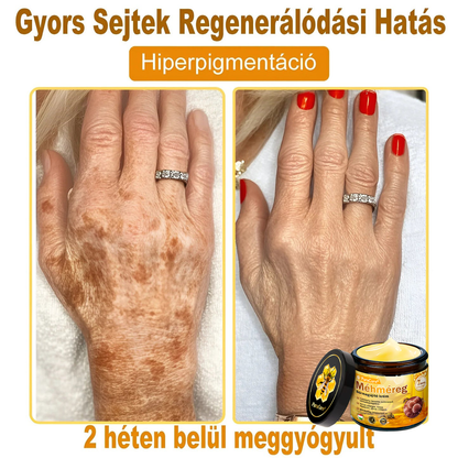 🔥🔥  𝐏𝐮𝐫𝐚𝐂𝐮𝐫𝐞® 𝐌é𝐡𝐦é𝐫𝐞𝐠 𝐁ő𝐫 𝐇𝐞𝐥𝐲𝐫𝐞á𝐥𝐥í𝐭ó 𝐊𝐫é𝐦 (👨‍⚕‍𝐂𝐄 𝐓𝐚𝐧ú𝐬í𝐭𝐯á𝐧𝐲)👍✅