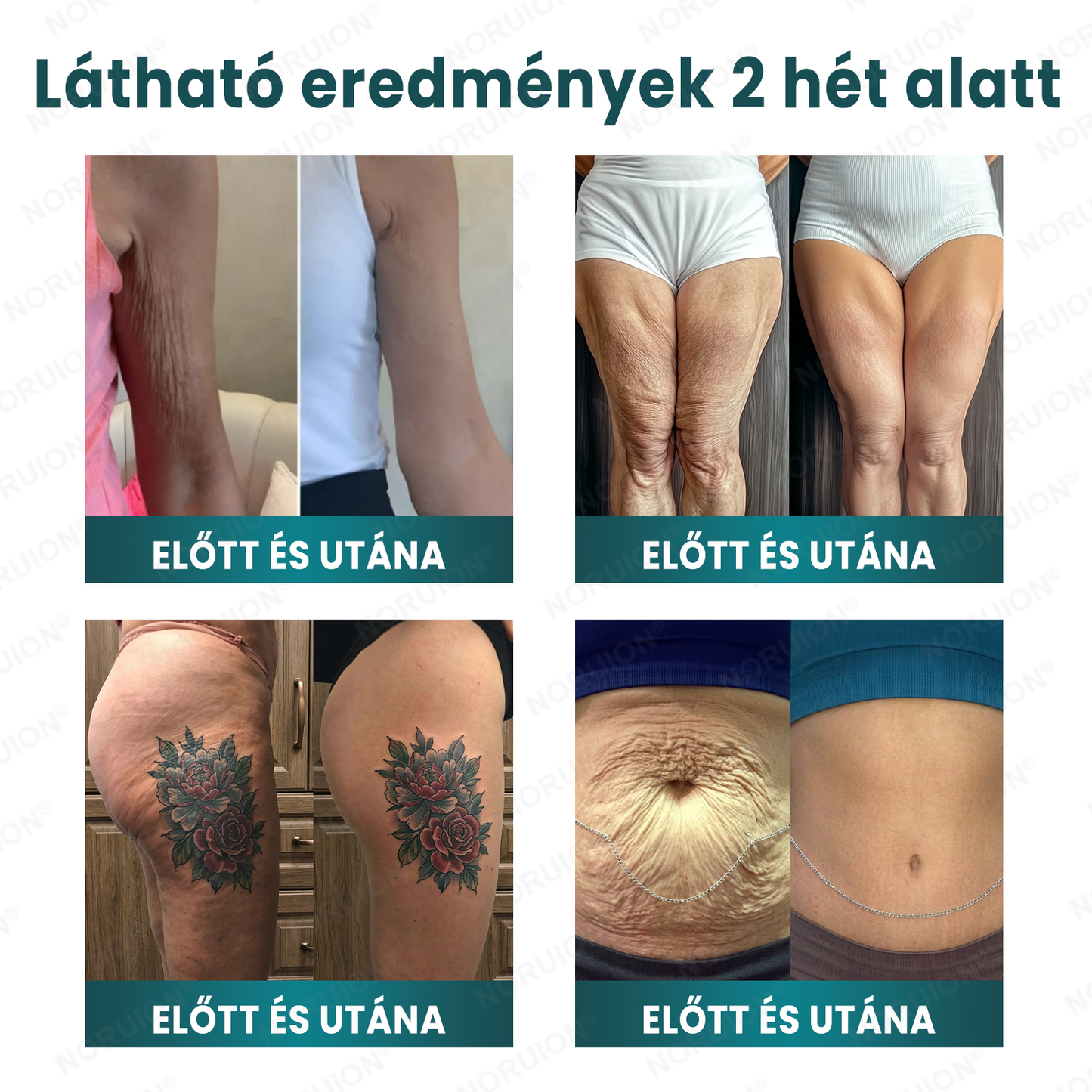 👨‍⚕️Bőrgyógyászok által ajánlott ✨ NORUION® Q10 x Növényi Nano Exoszóma Haladó Ránctalanító Krém
