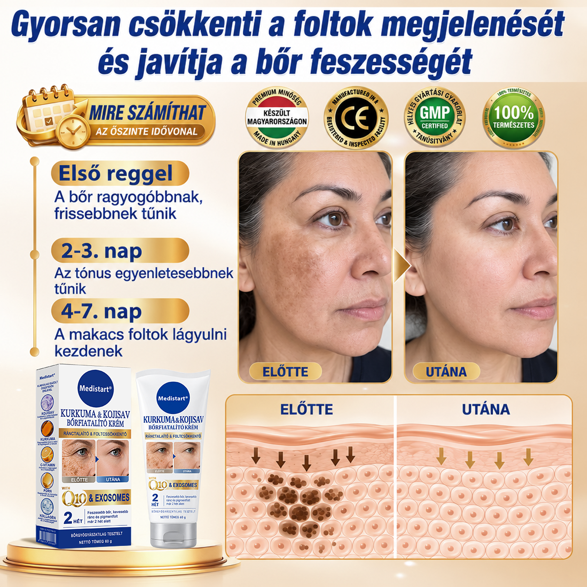 🧑‍⚕️Medistart® 𝐊𝐮𝐫𝐤𝐮𝐦𝐚 × 𝐊𝐨𝐣𝐢𝐧𝐬𝐚𝐯 𝐄́𝐣𝐬𝐳𝐚𝐤𝐚𝐢 Bőrfiatalító 𝐊𝐫𝐞́𝐦— 𝐇𝐚𝐥𝐯𝐚́𝐧𝐲𝐢́𝐭𝐬𝐝 𝐚 𝐦𝐚𝐤𝐚𝐜𝐬 𝐬𝐨̈𝐭𝐞́𝐭 𝐟𝐨𝐥𝐭𝐨𝐤𝐚𝐭 𝐞́𝐬 𝐬𝐢𝐦𝐢́𝐭𝐬𝐝 𝐤𝐢 𝐚 𝐥𝐚́𝐭𝐡𝐚𝐭𝐨́ 𝐫𝐚́𝐧𝐜𝐨𝐤𝐚𝐭 𝐚𝐥𝐯𝐚́𝐬 𝐤𝐨̈𝐳𝐛𝐞𝐧 🌙 ✅ 𝐄́𝐣𝐬𝐳𝐚𝐤𝐚́𝐧𝐤𝐞́𝐧𝐭 𝐞𝐠𝐲 𝐥𝐞́𝐩𝐞́𝐬 · 𝐋𝐚́𝐭𝐡𝐚𝐭𝐨́ 𝐯𝐚́𝐥𝐭𝐨𝐳𝐚́𝐬 𝟕 𝐞́𝐣𝐬𝐳𝐚𝐤𝐚 𝐚𝐥𝐚𝐭𝐭 💯