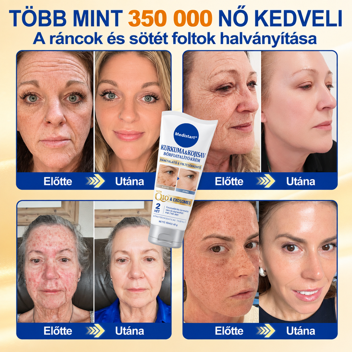 🧑‍⚕️Medistart® 𝐊𝐮𝐫𝐤𝐮𝐦𝐚 × 𝐊𝐨𝐣𝐢𝐧𝐬𝐚𝐯 𝐄́𝐣𝐬𝐳𝐚𝐤𝐚𝐢 Bőrfiatalító 𝐊𝐫𝐞́𝐦— 𝐇𝐚𝐥𝐯𝐚́𝐧𝐲𝐢́𝐭𝐬𝐝 𝐚 𝐦𝐚𝐤𝐚𝐜𝐬 𝐬𝐨̈𝐭𝐞́𝐭 𝐟𝐨𝐥𝐭𝐨𝐤𝐚𝐭 𝐞́𝐬 𝐬𝐢𝐦𝐢́𝐭𝐬𝐝 𝐤𝐢 𝐚 𝐥𝐚́𝐭𝐡𝐚𝐭𝐨́ 𝐫𝐚́𝐧𝐜𝐨𝐤𝐚𝐭 𝐚𝐥𝐯𝐚́𝐬 𝐤𝐨̈𝐳𝐛𝐞𝐧 🌙 ✅ 𝐄́𝐣𝐬𝐳𝐚𝐤𝐚́𝐧𝐤𝐞́𝐧𝐭 𝐞𝐠𝐲 𝐥𝐞́𝐩𝐞́𝐬 · 𝐋𝐚́𝐭𝐡𝐚𝐭𝐨́ 𝐯𝐚́𝐥𝐭𝐨𝐳𝐚́𝐬 𝟕 𝐞́𝐣𝐬𝐳𝐚𝐤𝐚 𝐚𝐥𝐚𝐭𝐭 💯