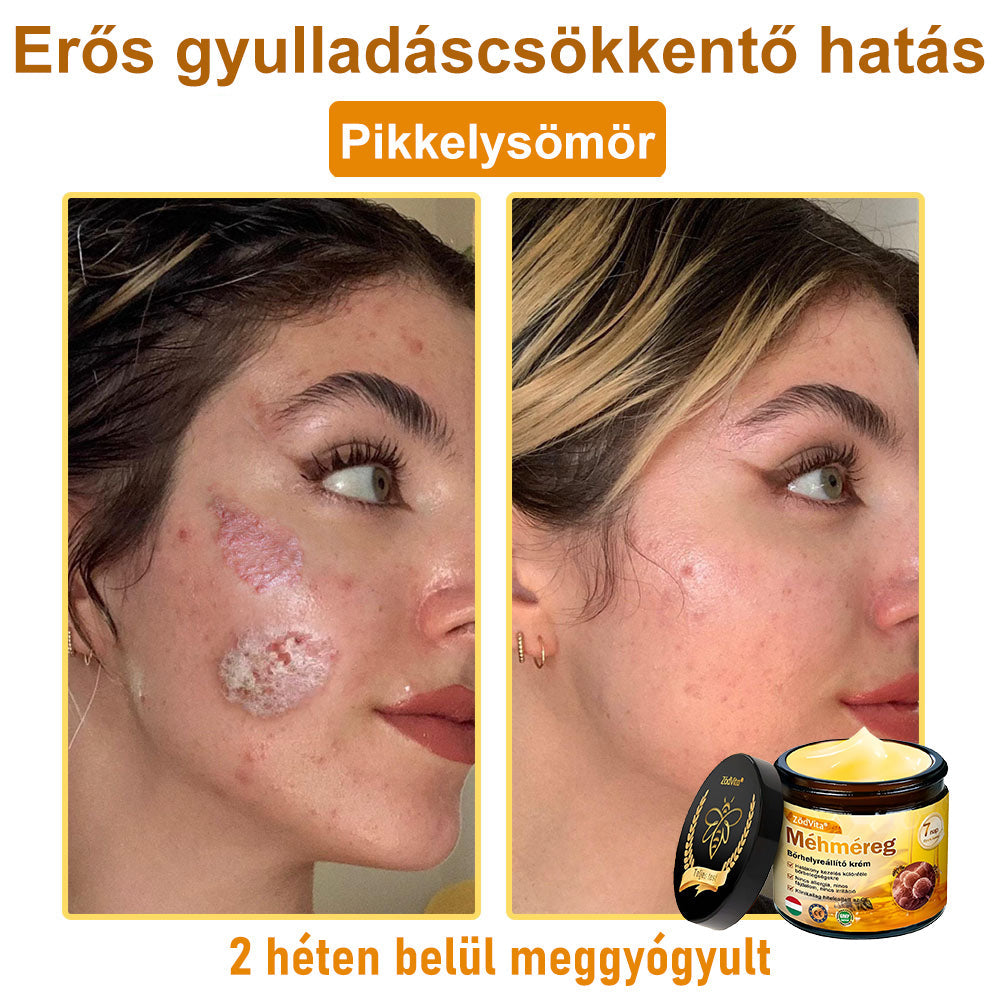 🎁 Már csak 5 doboz maradt! További 30% kedvezményt kínálunk! Szerezd meg most formában és egészségesen. Most veszítsd el, és nem lesz más lehetőséged jövőre.