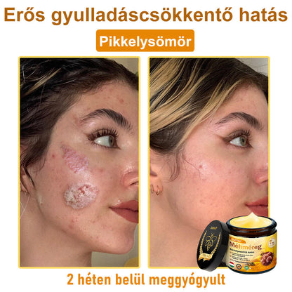 🎁 Már csak 5 doboz maradt! További 30% kedvezményt kínálunk! Szerezd meg most formában és egészségesen. Most veszítsd el, és nem lesz más lehetőséged jövőre.