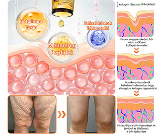 🔥🔥  𝐏𝐮𝐫𝐚𝐂𝐮𝐫𝐞® 𝐌é𝐡𝐦é𝐫𝐞𝐠 𝐁ő𝐫 𝐇𝐞𝐥𝐲𝐫𝐞á𝐥𝐥í𝐭ó 𝐊𝐫é𝐦 (👨‍⚕‍𝐂𝐄 𝐓𝐚𝐧ú𝐬í𝐭𝐯á𝐧𝐲)👍✅