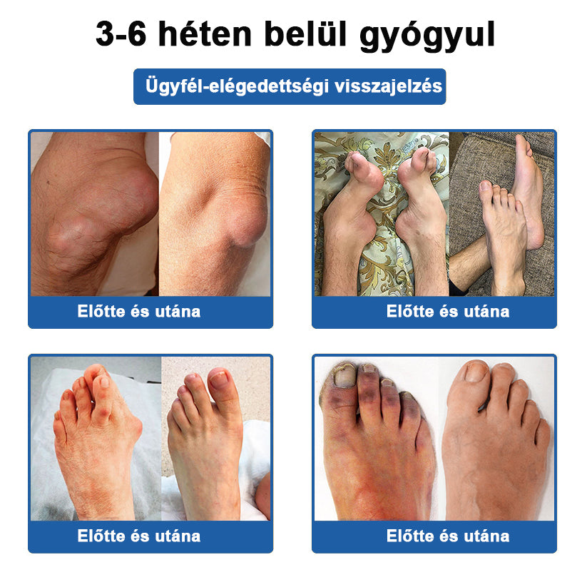 🏃 Medistart® 3 az 1-ben regeneráló krém ✨Ízületek és csontok számára, 5 perces fájdalomcsillapítás - 50 ml