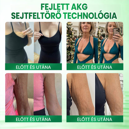 🎁 Medistart® Már csak 5 doboz maradt! További 30% kedvezményt kínálunk! Szerezd meg most formában és egészségesen. Most veszítsd el, és nem lesz más lehetőséged jövőre.