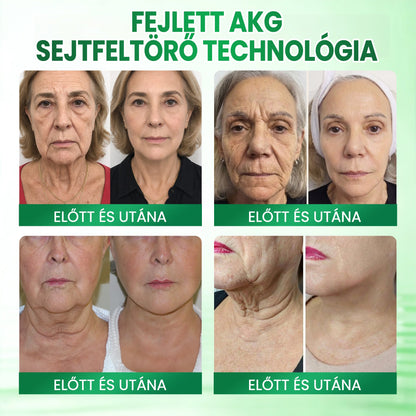 🎁 Medistart® Már csak 5 doboz maradt! További 30% kedvezményt kínálunk! Szerezd meg most formában és egészségesen. Most veszítsd el, és nem lesz más lehetőséged jövőre.