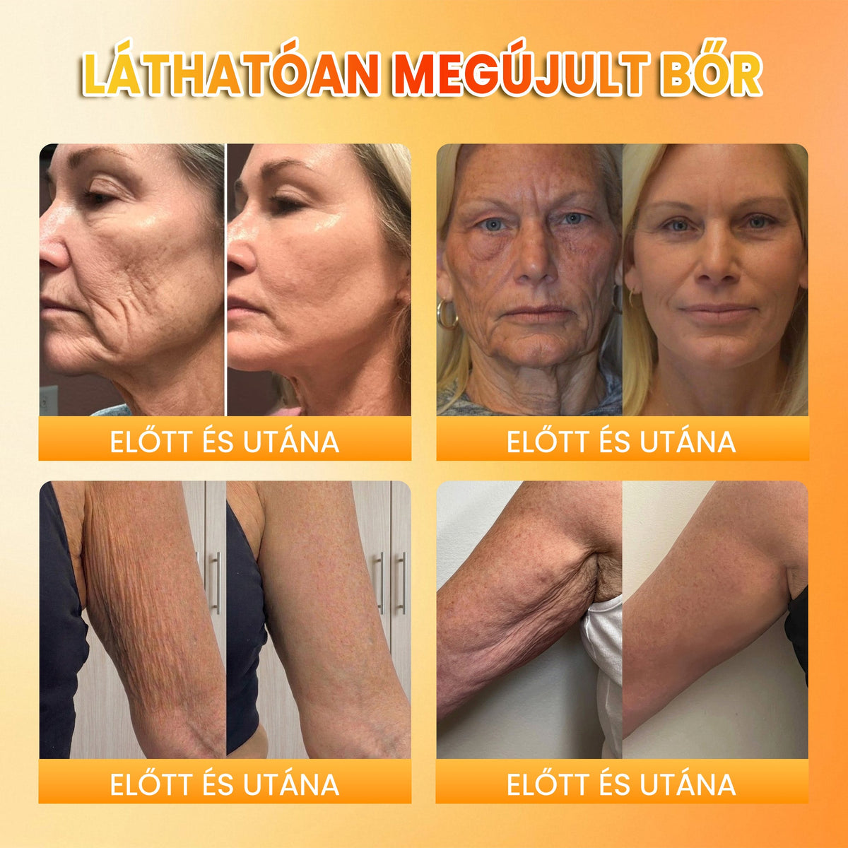 👉100K+ ELADVA -🧑‍⚕️PuraCure® méhpempő véraláfutás-javító és bőrerősítő krém (👍✅𝐂𝐄 𝐓𝐚𝐧ú𝐬í𝐭𝐯á𝐧𝐲)