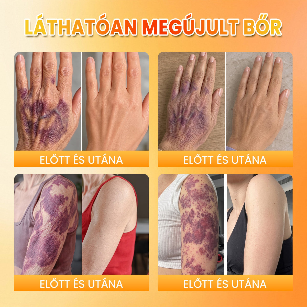 👉100K+ ELADVA -🧑‍⚕️PuraCure® méhpempő véraláfutás-javító és bőrerősítő krém (👍✅𝐂𝐄 𝐓𝐚𝐧ú𝐬í𝐭𝐯á𝐧𝐲)
