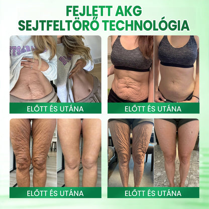 🎁 Medistart® Már csak 5 doboz maradt! További 30% kedvezményt kínálunk! Szerezd meg most formában és egészségesen. Most veszítsd el, és nem lesz más lehetőséged jövőre.