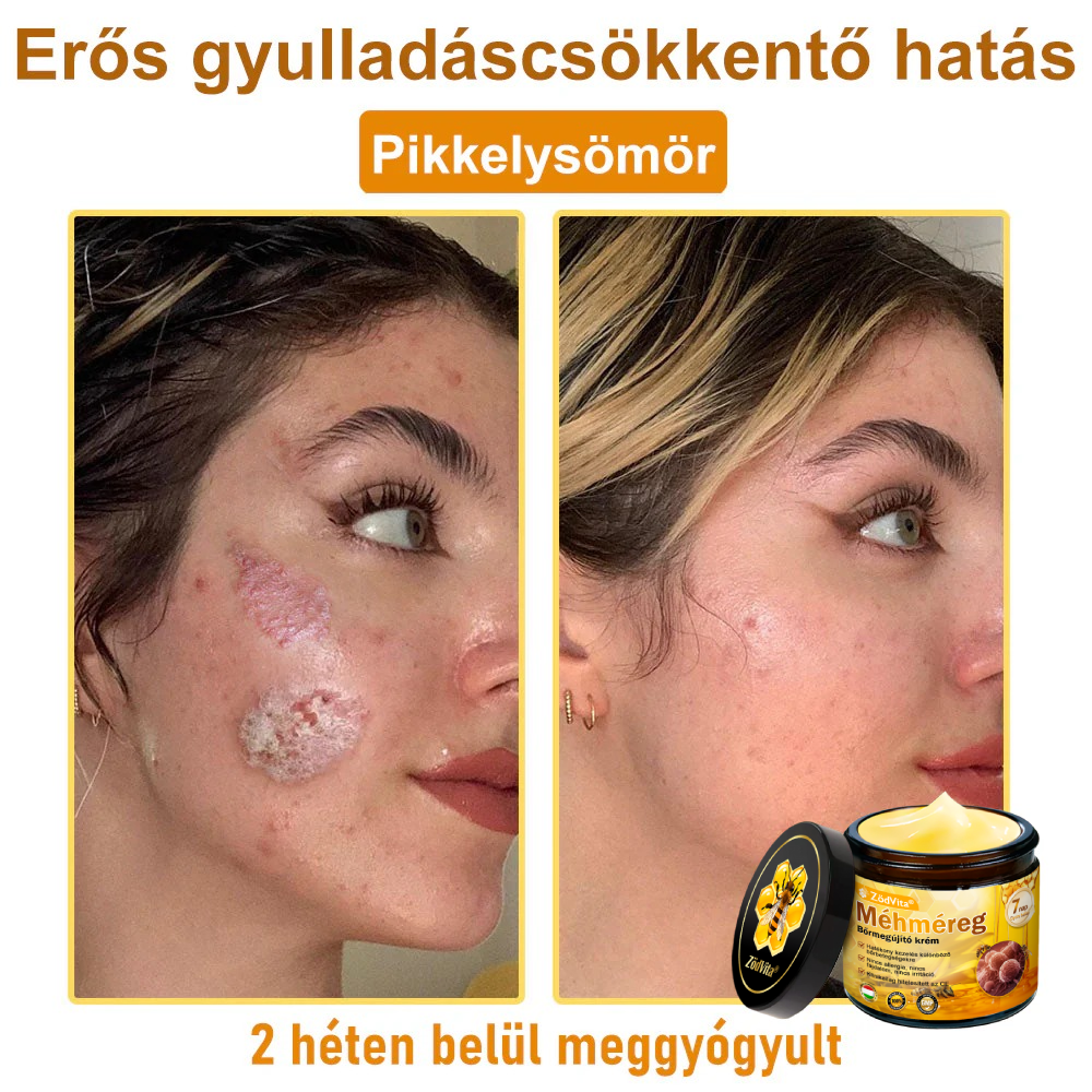 🔥ZödVita® Méhméreg Bőr Helyreállító Krém (👨‍⚕‍CE Tanúsítvány)👍✅