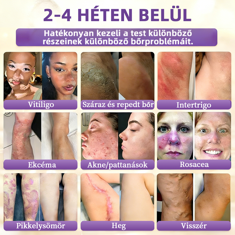 ✨ NORUION® Biotin 10 az 1-ben Bőrmegújító Krém  (👨‍⚕‍CE Tanúsítvány)👍✅ Magyar fejlesztés, magyarországi gyártás és szállítás