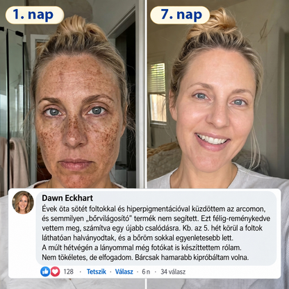 🧑‍⚕️Medistart® 𝐊𝐮𝐫𝐤𝐮𝐦𝐚 × 𝐊𝐨𝐣𝐢𝐧𝐬𝐚𝐯 𝐄́𝐣𝐬𝐳𝐚𝐤𝐚𝐢 Bőrfiatalító 𝐊𝐫𝐞́𝐦— 𝐇𝐚𝐥𝐯𝐚́𝐧𝐲𝐢́𝐭𝐬𝐝 𝐚 𝐦𝐚𝐤𝐚𝐜𝐬 𝐬𝐨̈𝐭𝐞́𝐭 𝐟𝐨𝐥𝐭𝐨𝐤𝐚𝐭 𝐞́𝐬 𝐬𝐢𝐦𝐢́𝐭𝐬𝐝 𝐤𝐢 𝐚 𝐥𝐚́𝐭𝐡𝐚𝐭𝐨́ 𝐫𝐚́𝐧𝐜𝐨𝐤𝐚𝐭 𝐚𝐥𝐯𝐚́𝐬 𝐤𝐨̈𝐳𝐛𝐞𝐧 🌙 ✅ 𝐄́𝐣𝐬𝐳𝐚𝐤𝐚́𝐧𝐤𝐞́𝐧𝐭 𝐞𝐠𝐲 𝐥𝐞́𝐩𝐞́𝐬 · 𝐋𝐚́𝐭𝐡𝐚𝐭𝐨́ 𝐯𝐚́𝐥𝐭𝐨𝐳𝐚́𝐬 𝟕 𝐞́𝐣𝐬𝐳𝐚𝐤𝐚 𝐚𝐥𝐚𝐭𝐭 💯