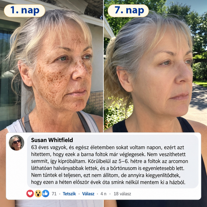 🧑‍⚕️Medistart® 𝐊𝐮𝐫𝐤𝐮𝐦𝐚 × 𝐊𝐨𝐣𝐢𝐧𝐬𝐚𝐯 𝐄́𝐣𝐬𝐳𝐚𝐤𝐚𝐢 Bőrfiatalító 𝐊𝐫𝐞́𝐦— 𝐇𝐚𝐥𝐯𝐚́𝐧𝐲𝐢́𝐭𝐬𝐝 𝐚 𝐦𝐚𝐤𝐚𝐜𝐬 𝐬𝐨̈𝐭𝐞́𝐭 𝐟𝐨𝐥𝐭𝐨𝐤𝐚𝐭 𝐞́𝐬 𝐬𝐢𝐦𝐢́𝐭𝐬𝐝 𝐤𝐢 𝐚 𝐥𝐚́𝐭𝐡𝐚𝐭𝐨́ 𝐫𝐚́𝐧𝐜𝐨𝐤𝐚𝐭 𝐚𝐥𝐯𝐚́𝐬 𝐤𝐨̈𝐳𝐛𝐞𝐧 🌙 ✅ 𝐄́𝐣𝐬𝐳𝐚𝐤𝐚́𝐧𝐤𝐞́𝐧𝐭 𝐞𝐠𝐲 𝐥𝐞́𝐩𝐞́𝐬 · 𝐋𝐚́𝐭𝐡𝐚𝐭𝐨́ 𝐯𝐚́𝐥𝐭𝐨𝐳𝐚́𝐬 𝟕 𝐞́𝐣𝐬𝐳𝐚𝐤𝐚 𝐚𝐥𝐚𝐭𝐭 💯