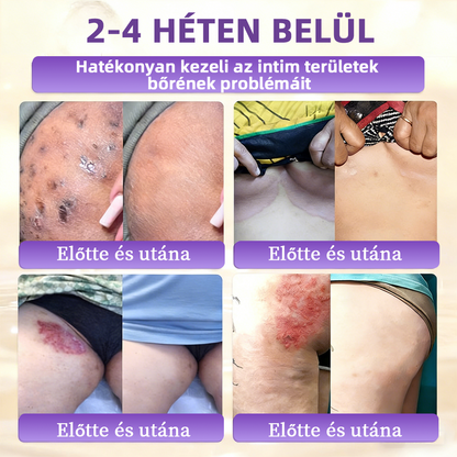✨ NORUION® Biotin 10 az 1-ben Bőrmegújító Krém  (👨‍⚕‍CE Tanúsítvány)👍✅ Magyar fejlesztés, magyarországi gyártás és szállítás