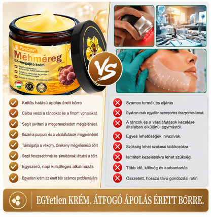 👉100K+ ELADVA -🧑‍⚕️PuraCure® méhpempő véraláfutás-javító és bőrerősítő krém (👍✅𝐂𝐄 𝐓𝐚𝐧ú𝐬í𝐭𝐯á𝐧𝐲)