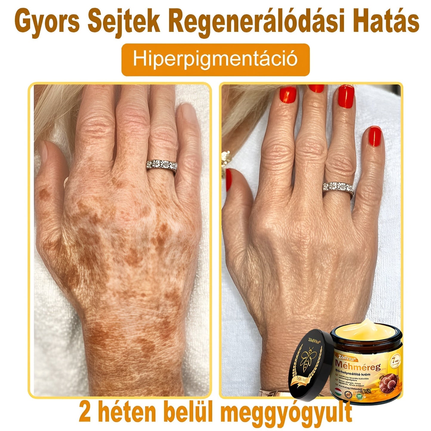 🧑‍⚕️ ZödVita® Méhméreg Bőr Helyreállító Krém 🔥 Magyar fejlesztés, magyarországi gyártás és szállítás