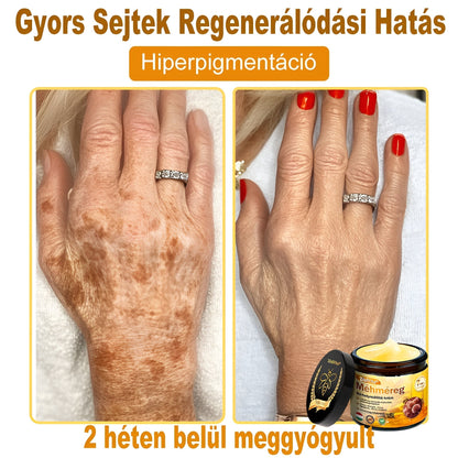 🧑‍⚕️ ZödVita® Méhméreg Bőr Helyreállító Krém 🔥 Magyar fejlesztés, magyarországi gyártás és szállítás