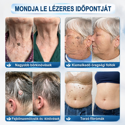 ✨𝐏𝐮𝐫𝐚𝐂𝐮𝐫𝐞® 𝐌𝐢𝐤𝐫𝐨-𝐭ű𝐬 𝐛𝐨𝐭𝐚𝐧𝐢𝐤𝐚𝐢 𝐛ő𝐫𝐧ö𝐯𝐞𝐝é𝐤-𝐞𝐥𝐭á𝐯𝐨𝐥í𝐭ó ✅✅𝐊é𝐬𝐳ü𝐥𝐭 𝐌𝐚𝐠𝐲𝐚𝐫𝐨𝐫𝐬𝐳á𝐠𝐨𝐧