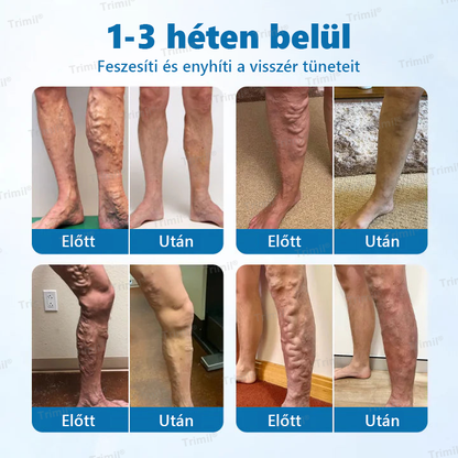 💚Trimil® VeinGuard Gyógynövényes Spray - ✅ Klinikailag bizonyított, hogy mindössze 7 nap alatt megszünteti a visszereket!