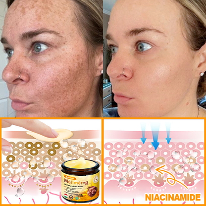 🐝 ZödVita® Méhméreg Bőr Helyreállító Krém (👨‍⚕‍CE Tanúsítvány)👍✅
