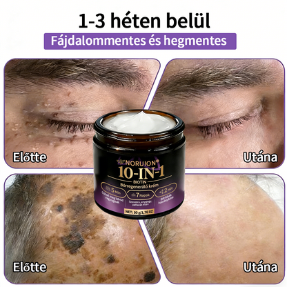 ✨ NORUION® Biotin 10 az 1-ben Bőrmegújító Krém  (👨‍⚕‍CE Tanúsítvány)👍✅ Magyar fejlesztés, magyarországi gyártás és szállítás