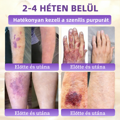 ✨ NORUION® Biotin 10 az 1-ben Bőrmegújító Krém  (👨‍⚕‍CE Tanúsítvány)👍✅ Magyar fejlesztés, magyarországi gyártás és szállítás