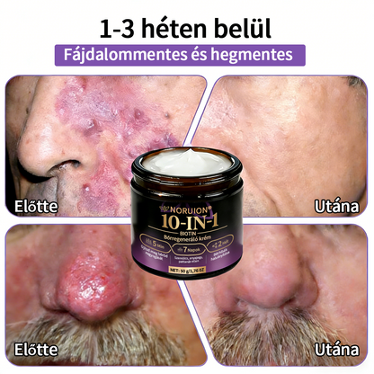 ✨ NORUION® Biotin 10 az 1-ben Bőrmegújító Krém  (👨‍⚕‍CE Tanúsítvány)👍✅ Magyar fejlesztés, magyarországi gyártás és szállítás