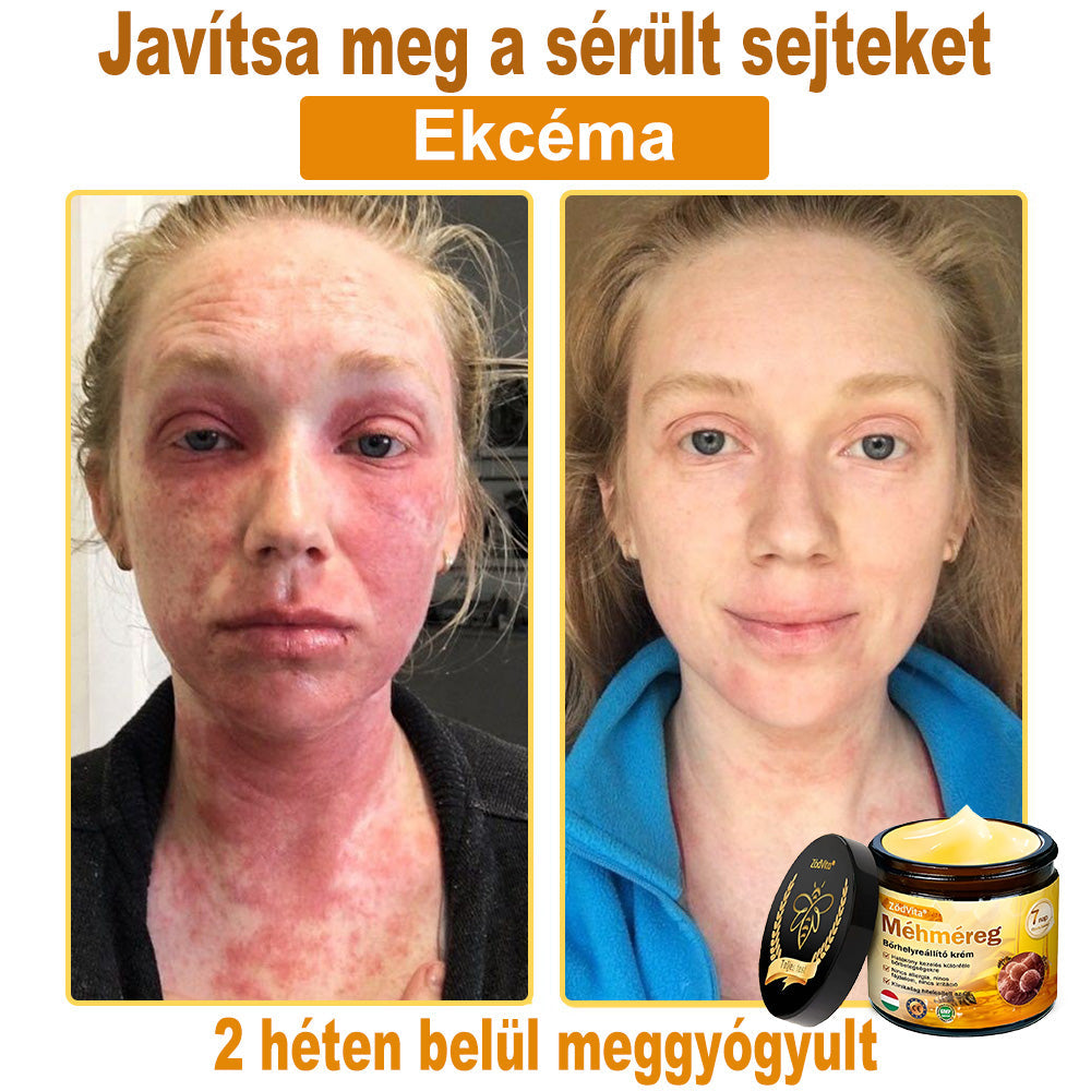 🎁 Már csak 5 doboz maradt! További 30% kedvezményt kínálunk! Szerezd meg most formában és egészségesen. Most veszítsd el, és nem lesz más lehetőséged jövőre.