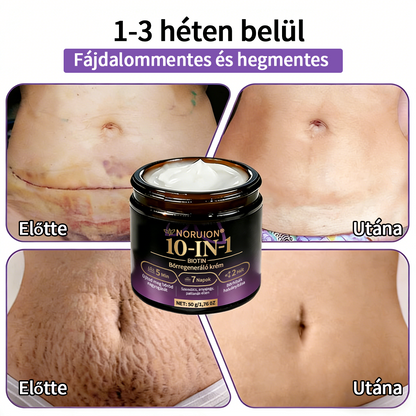 ✨ NORUION® Biotin 10 az 1-ben Bőrmegújító Krém  (👨‍⚕‍CE Tanúsítvány)👍✅ Magyar fejlesztés, magyarországi gyártás és szállítás