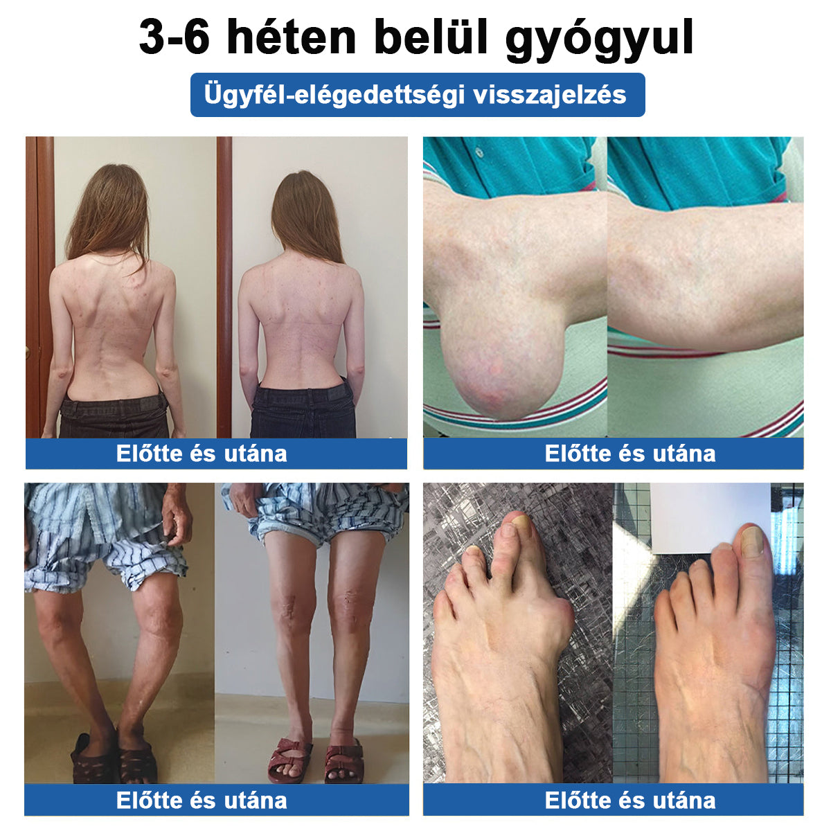 🏃 Medistart® 3 az 1-ben regeneráló krém ✨Ízületek és csontok számára, 5 perces fájdalomcsillapítás - 50 ml