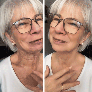 👨‍⚕️Bőrgyógyászok által ajánlott ✨ NORUION® Q10 x Növényi Nano Exoszóma Haladó Ránctalanító Krém