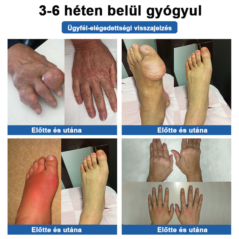 🏃 Medistart® 3 az 1-ben regeneráló krém ✨Ízületek és csontok számára, 5 perces fájdalomcsillapítás - 50 ml