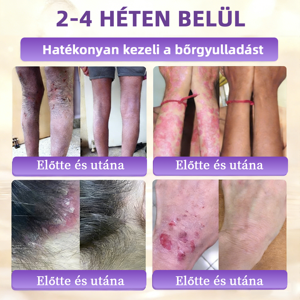 ✨ NORUION® Biotin 10 az 1-ben Bőrmegújító Krém  (👨‍⚕‍CE Tanúsítvány)👍✅ Magyar fejlesztés, magyarországi gyártás és szállítás