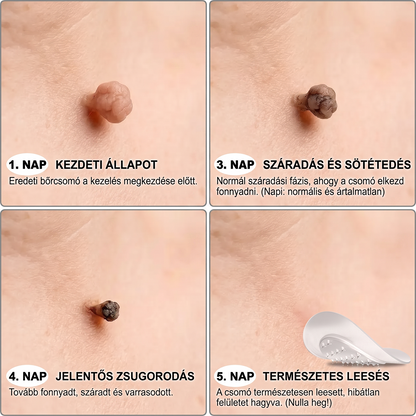 ✨𝐏𝐮𝐫𝐚𝐂𝐮𝐫𝐞® 𝐌𝐢𝐤𝐫𝐨-𝐭ű𝐬 𝐛𝐨𝐭𝐚𝐧𝐢𝐤𝐚𝐢 𝐛ő𝐫𝐧ö𝐯𝐞𝐝é𝐤-𝐞𝐥𝐭á𝐯𝐨𝐥í𝐭ó ✅✅𝐊é𝐬𝐳ü𝐥𝐭 𝐌𝐚𝐠𝐲𝐚𝐫𝐨𝐫𝐬𝐳á𝐠𝐨𝐧