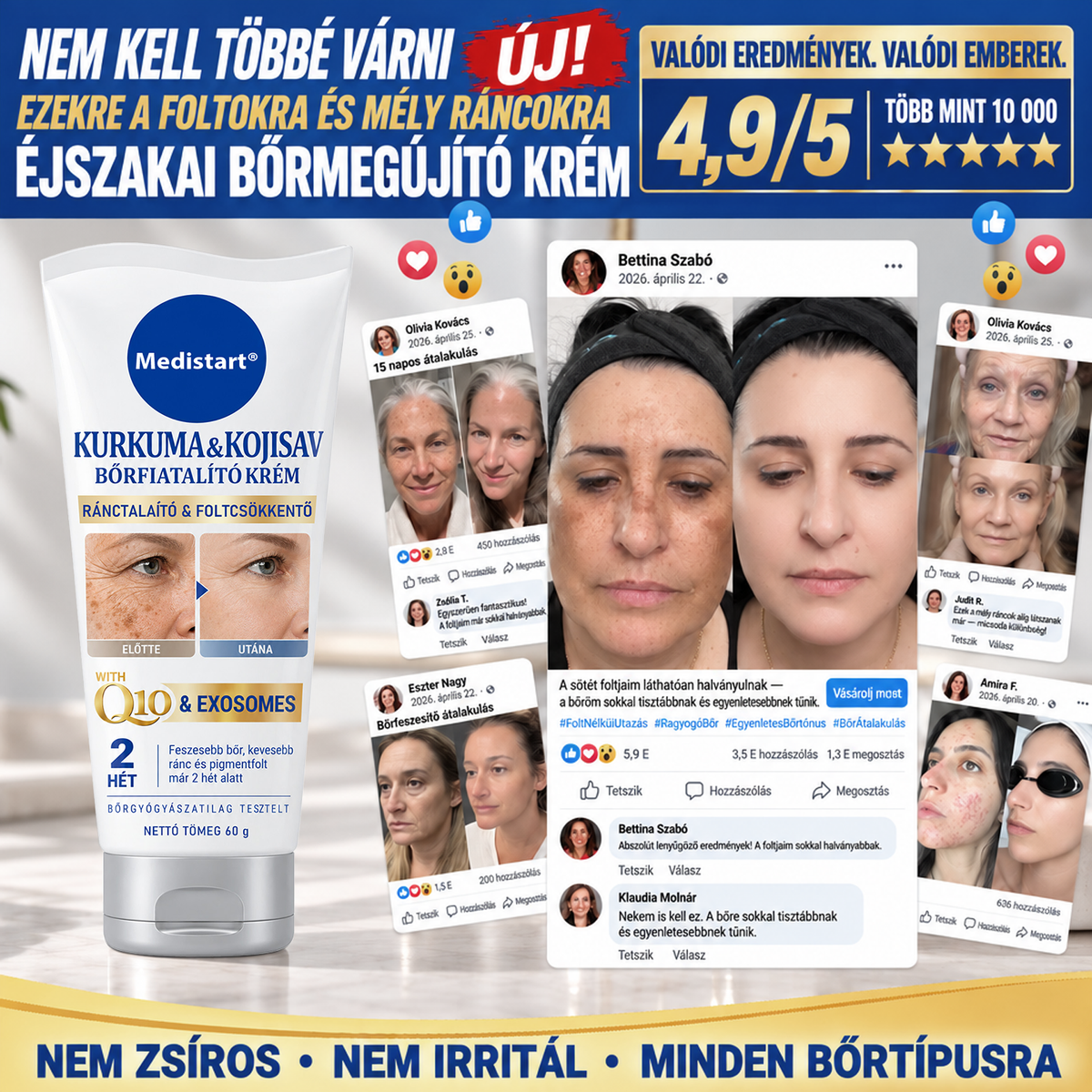 🧑‍⚕️Medistart® 𝐊𝐮𝐫𝐤𝐮𝐦𝐚 × 𝐊𝐨𝐣𝐢𝐧𝐬𝐚𝐯 𝐄́𝐣𝐬𝐳𝐚𝐤𝐚𝐢 Bőrfiatalító 𝐊𝐫𝐞́𝐦— 𝐇𝐚𝐥𝐯𝐚́𝐧𝐲𝐢́𝐭𝐬𝐝 𝐚 𝐦𝐚𝐤𝐚𝐜𝐬 𝐬𝐨̈𝐭𝐞́𝐭 𝐟𝐨𝐥𝐭𝐨𝐤𝐚𝐭 𝐞́𝐬 𝐬𝐢𝐦𝐢́𝐭𝐬𝐝 𝐤𝐢 𝐚 𝐥𝐚́𝐭𝐡𝐚𝐭𝐨́ 𝐫𝐚́𝐧𝐜𝐨𝐤𝐚𝐭 𝐚𝐥𝐯𝐚́𝐬 𝐤𝐨̈𝐳𝐛𝐞𝐧 🌙 ✅ 𝐄́𝐣𝐬𝐳𝐚𝐤𝐚́𝐧𝐤𝐞́𝐧𝐭 𝐞𝐠𝐲 𝐥𝐞́𝐩𝐞́𝐬 · 𝐋𝐚́𝐭𝐡𝐚𝐭𝐨́ 𝐯𝐚́𝐥𝐭𝐨𝐳𝐚́𝐬 𝟕 𝐞́𝐣𝐬𝐳𝐚𝐤𝐚 𝐚𝐥𝐚𝐭𝐭 💯