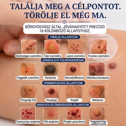 ✨𝐏𝐮𝐫𝐚𝐂𝐮𝐫𝐞® 𝐌𝐢𝐤𝐫𝐨-𝐭ű𝐬 𝐛𝐨𝐭𝐚𝐧𝐢𝐤𝐚𝐢 𝐛ő𝐫𝐧ö𝐯𝐞𝐝é𝐤-𝐞𝐥𝐭á𝐯𝐨𝐥í𝐭ó ✅✅𝐊é𝐬𝐳ü𝐥𝐭 𝐌𝐚𝐠𝐲𝐚𝐫𝐨𝐫𝐬𝐳á𝐠𝐨𝐧