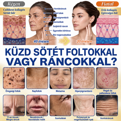 🧑‍⚕️Medistart® 𝐊𝐮𝐫𝐤𝐮𝐦𝐚 × 𝐊𝐨𝐣𝐢𝐧𝐬𝐚𝐯 𝐄́𝐣𝐬𝐳𝐚𝐤𝐚𝐢 Bőrfiatalító 𝐊𝐫𝐞́𝐦— 𝐇𝐚𝐥𝐯𝐚́𝐧𝐲𝐢́𝐭𝐬𝐝 𝐚 𝐦𝐚𝐤𝐚𝐜𝐬 𝐬𝐨̈𝐭𝐞́𝐭 𝐟𝐨𝐥𝐭𝐨𝐤𝐚𝐭 𝐞́𝐬 𝐬𝐢𝐦𝐢́𝐭𝐬𝐝 𝐤𝐢 𝐚 𝐥𝐚́𝐭𝐡𝐚𝐭𝐨́ 𝐫𝐚́𝐧𝐜𝐨𝐤𝐚𝐭 𝐚𝐥𝐯𝐚́𝐬 𝐤𝐨̈𝐳𝐛𝐞𝐧 🌙 ✅ 𝐄́𝐣𝐬𝐳𝐚𝐤𝐚́𝐧𝐤𝐞́𝐧𝐭 𝐞𝐠𝐲 𝐥𝐞́𝐩𝐞́𝐬 · 𝐋𝐚́𝐭𝐡𝐚𝐭𝐨́ 𝐯𝐚́𝐥𝐭𝐨𝐳𝐚́𝐬 𝟕 𝐞́𝐣𝐬𝐳𝐚𝐤𝐚 𝐚𝐥𝐚𝐭𝐭 💯