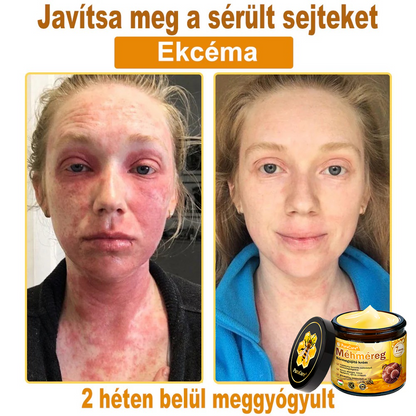 🔥🔥  𝐏𝐮𝐫𝐚𝐂𝐮𝐫𝐞® 𝐌é𝐡𝐦é𝐫𝐞𝐠 𝐁ő𝐫 𝐇𝐞𝐥𝐲𝐫𝐞á𝐥𝐥í𝐭ó 𝐊𝐫é𝐦 (👨‍⚕‍𝐂𝐄 𝐓𝐚𝐧ú𝐬í𝐭𝐯á𝐧𝐲)👍✅