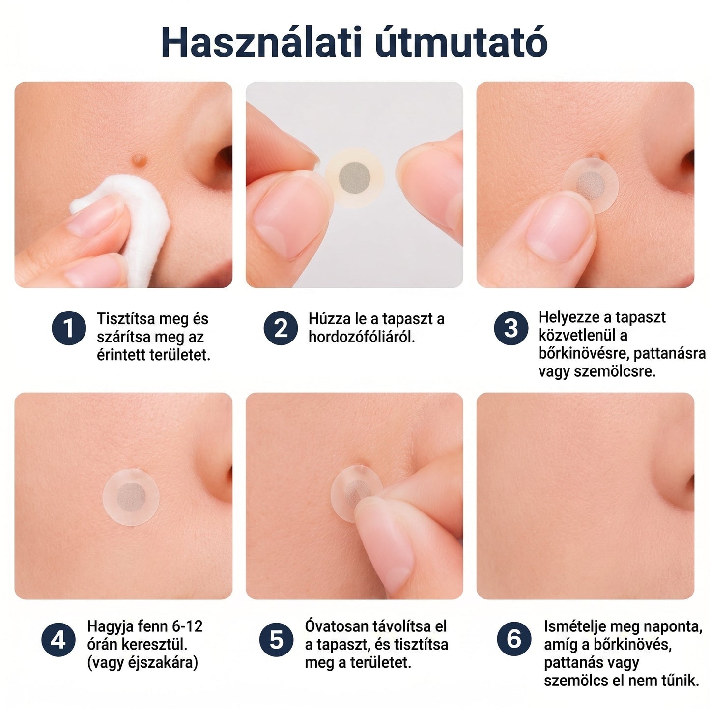 🧑‍⚕️ PuraCure® 2 az 1-ben mikrotűs és hidrokolloid tapasz🍀 | Kiálló anyajegyek, aknék, lapos szemölcsök és bőrnövedékek eltávolítására | Segít csökkenteni a ráncokat, hegeket és bőrhibákat | Láthatatlan tapasz az arcra és testre