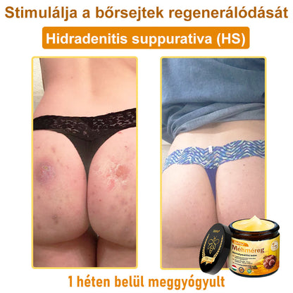 🎁 Már csak 5 doboz maradt! További 30% kedvezményt kínálunk! Szerezd meg most formában és egészségesen. Most veszítsd el, és nem lesz más lehetőséged jövőre.